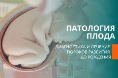 Узнать подробнее